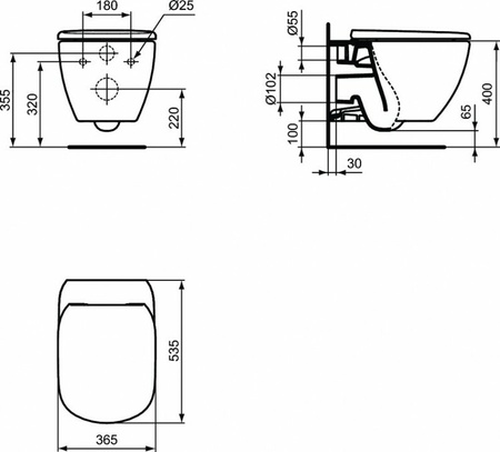 Комплект унитаза с инсталляцией 4 в 1 Ideal Standard Esedra T387301